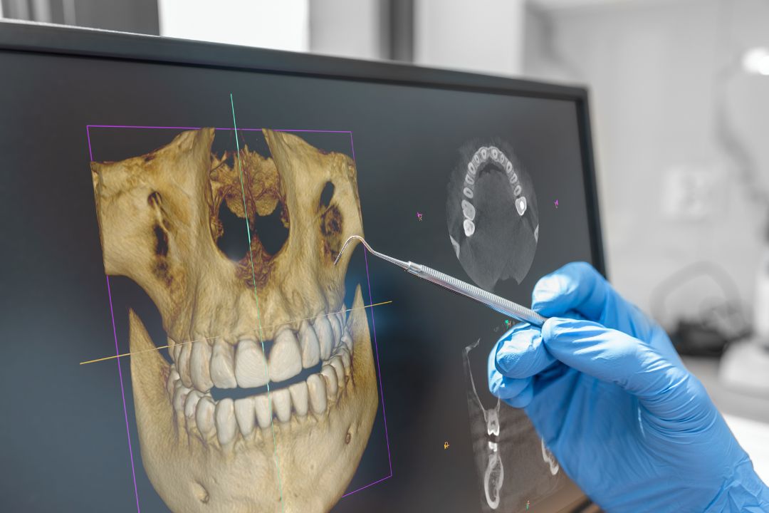 How 3D Imaging Enhances Dental Care and Treatment